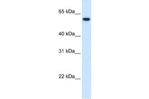 FTCD antibody used at 1. (FTCD Antikörper  (N-Term))