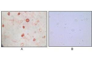 Immunocytochemistry analysis of TPA induced BCBL-1 cells (A) and uninduced BCBL-1 cells (B) using KSHV K8a antibody with AEC staining. (KSHV K8 alpha Antikörper)