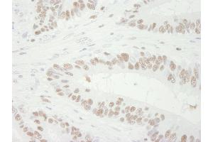 Immunohistochemistry (IHC) image for anti-Minichromosome Maintenance Complex Component 3 (MCM3) (AA 500-550) antibody (ABIN7448651)