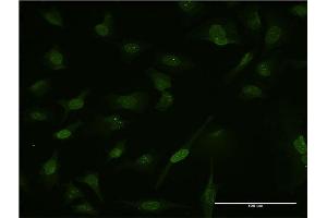 Immunofluorescence (IF) image for anti-Calcium Regulated Heat Stable Protein 1, 24kDa (CARHSP1) (AA 1-147) antibody (ABIN949131)