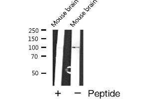 Western blot analysis of GluR6 expression in Mouse brain extracts (Metabotropic Glutamate Receptor 6 Antikörper  (C-Term))