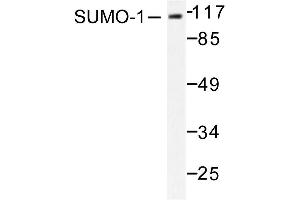 Image no. 1 for anti-Small Ubiquitin Related Modifier Protein 1 (SUMO1) antibody (ABIN271962) (SUMO1 Antikörper)