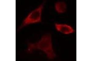 ABIN6275359 staining Hela cells by IF/ICC.