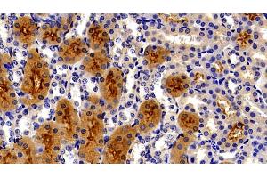 Immunohistochemistry (IHC) image for anti-Meprin A, alpha (PABA Peptide Hydrolase) (MEP1A) (AA 219-463) antibody (ABIN7439561)