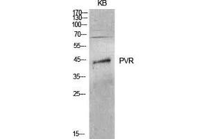 Western Blot (WB) analysis of KB cells using CD155 Polyclonal Antibody. (Poliovirus Receptor Antikörper  (Internal Region))