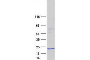 CALML4 Protein (Transcript Variant 2) (Myc-DYKDDDDK Tag)