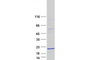 Validation with Western Blot (CALML4 Protein (Transcript Variant 2) (Myc-DYKDDDDK Tag))