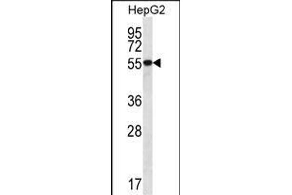 UGDH Antikörper  (C-Term)