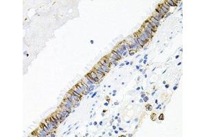 Immunohistochemistry of paraffin-embedded Human lung using ACVR2A Polyclonal Antibody at dilution of 1:100 (40x lens). (ACVR2A Antikörper)