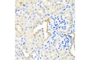 Immunohistochemistry of paraffin-embedded mouse kidney using TDGF1 antibody. (TDGF1 Antikörper)