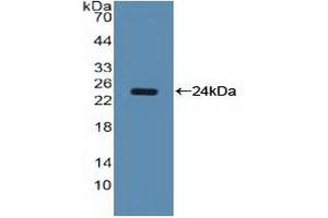 Western blot analysis of recombinant Human NCL. (Nucleolin Antikörper  (AA 388-569))