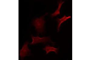 ABIN6275400 staining Hela by IF/ICC. (ZDHHC20 Antikörper  (Internal Region))