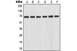 Western blot analysis of NRF2 expression in THP1 (A), HL60 (B), K562 (C), Jurkat (D), mouse kidney (E), rat kidney (F) whole cell lysates. (NRF2 Antikörper  (C-Term))