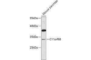 Western blot analysis of extracts of Mouse pancreas, using C11orf68 antibody (ABIN7266371) at 1:1000 dilution. (C11orf68 Antikörper  (AA 42-292))