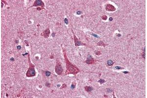 Human Brain, Cortex (formalin-fixed, paraffin-embedded) stained with YWHAQ antibody ABIN364361 at 10 ug/ml followed by biotinylated anti-mouse IgG secondary antibody ABIN481714, alkaline phosphatase-streptavidin and chromogen. (14-3-3 theta Antikörper  (AA 1-245))