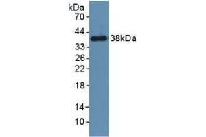 Western blot analysis of recombinant Mouse PDGFRb. (PDGFRB Antikörper  (AA 337-583))