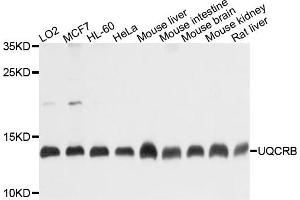 Western blot analysis of extracts of various cells, using UQCRB antibody. (UQCRB Antikörper)