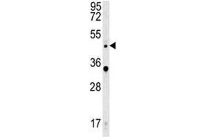 WNT5A antibody western blot analysis in HeLa lysate. (WNT5A Antikörper  (AA 185-213))