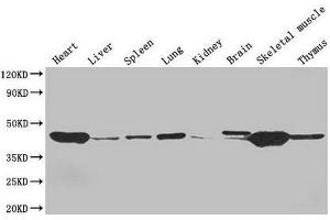 Western Blot Positive WB detected in: Mouse heart tissue, Mouse liver tissue, Mouse spleen tissue, Mouse lung tissue, Mouse kidney tissue, Mouse brain tissue, Mouse skeletal muscle tissue, Mouse thymus tissue All lanes: ACTA1 antibody at 4 μg/mL Secondary Goat polyclonal to rabbit IgG at 1/50000 dilution Predicted band size: 43 kDa Observed band size: 43 kDa (Actin Antikörper  (AA 3-377))