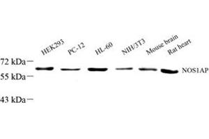 Western blot analysis of NOS1AP (ABIN7074844) at dilution of 1: 1000 (NOS1AP Antikörper)