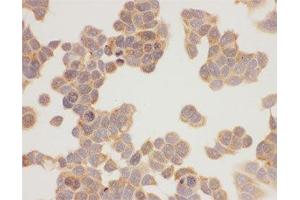 ICC testing of HSP90 antibody and MCF-7 cells (HSP90AA1 Antikörper  (AA 2-365))