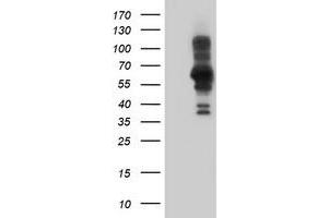 Western Blotting (WB) image for anti-PDZ and LIM Domain 5 (PDLIM5) antibody (ABIN1500131) (PDLIM5 Antikörper)