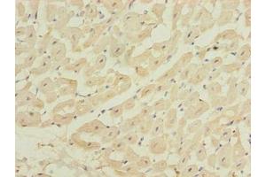 Immunohistochemistry of paraffin-embedded human heart tissue using ABIN7175990 at dilution of 1:100
