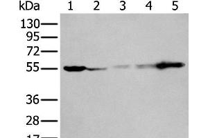 Western blot analysis of 293T A549 A431 Hela and Jurkat cell lysates using PFKFB3 Polyclonal Antibody at dilution of 1:400 (PFKFB3 Antikörper)