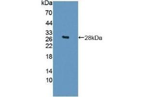 Detection of Recombinant Sp17, Mouse using Polyclonal Antibody to Sperm Protein 17 (Sp17) (SPA17 Antikörper  (AA 1-149))