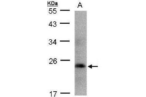 WB Image Sample(30 ug whole cell lysate) A:293T 12% SDS PAGE antibody diluted at 1:1000 (Growth Hormone 1 Antikörper)