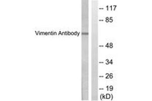 Western blot analysis of extracts from HepG2 cells, treated with Adriamycin 0. (Vimentin Antikörper  (AA 411-460))