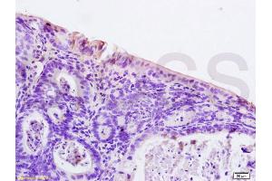 Immunohistochemistry (IHC) image for anti-Nuclear Receptor Subfamily 1, Group I, Member 2 (NR1I2) (AA 101-150) antibody (ABIN738816)