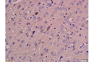 Formalin-fixed and paraffin embedded rat brain labeled with Anti-MCT4 Polyclonal Antibody, Unconjugated  at 1:200 followed by conjugation to the secondary antibody and DAB staining.