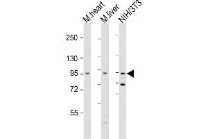 All lanes : Anti-Insr Antibody  at 1:2000 dilution Lane 1: mouse heart lysate Lane 2: mouse liver lysate Lane 3: NIH/3T3 whole cell lysate Lysates/proteins at 20 μg per lane. (Insulin Receptor Antikörper  (AA 1325-1358))