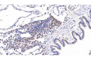 Immunohistochemistry (IHC) image for anti-Tenascin C (TNC) (AA 513-621) antibody (ABIN7434452)