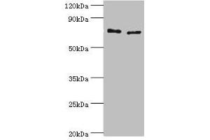 Western blot All lanes: Protein-glutamine gamma-glutamyltransferase 2 antibody at 8 μg/mL Lane 1: Hela whole cell lysate Lane 2: HepG2 whole cell lysate Secondary Goat polyclonal to rabbit IgG at 1/10000 dilution Predicted band size: 78, 62, 39 kDa Observed band size: 78 kDa (Transglutaminase 2 Antikörper  (AA 438-687))