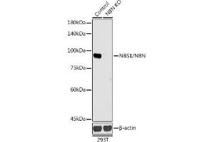Western blot analysis of extracts from normal (control) and NBS1/NBS1/NBN knockout (KO) 293T cells, using NBS1/NBS1/NBN antibody (ABIN1681204, ABIN3015326, ABIN3015327 and ABIN5663771) at 1:1000 dilution. (Nibrin Antikörper  (AA 435-754))