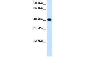 WB Suggested Anti-ADH4 Antibody Titration:  1. (ADH4 Antikörper  (Middle Region))