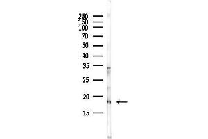 anti-Ubiquitin-Conjugating Enzyme E2I (UBE2I) (N-Term) antibody