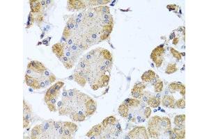 Immunohistochemistry of paraffin-embedded Human stomach using ITPKB Polyclonal Antibody at dilution of 1:100 (40x lens).