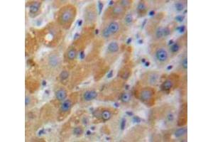 Used in DAB staining on fromalin fixed paraffin-embedded Liver tissue (MBL2 Antikörper  (AA 129-244))