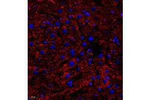 Immunofluorescence of paraffin embedded human liver using B0K (ABIN7073200) at dilution of 1:750 (400x lens) (BOK Antikörper)