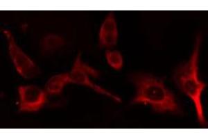 ABIN6266922 staining HT29 cells by IF/ICC. (CYP2B6 Antikörper)
