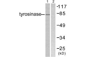 Western Blotting (WB) image for anti-Tyrosinase (TYR) (C-Term) antibody (ABIN1848870) (TYR Antikörper  (C-Term))
