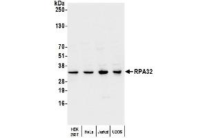 Western Blotting (WB) image for anti-Replication Protein A2, 32kDa (RPA2) (C-Term) antibody (ABIN7454599) (RPA2 Antikörper  (C-Term))
