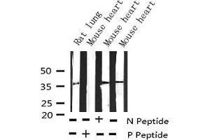 Western blot analysis of Phospho-EFNB1/2 (Tyr330) expression in various lysates (Ephrin B2 Antikörper  (pTyr330))