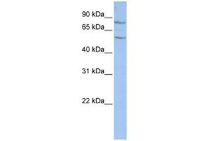 TCTE1 antibody used at 1 ug/ml to detect target protein. (TCTE1 Antikörper  (Middle Region))