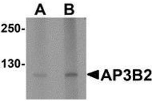 Western blot analysis of AP3B2 in rat brain tissue lysate with AP3B2 antibody at (A) 1 and (B) 2 µg/ml. (AP3B2 Antikörper  (N-Term))