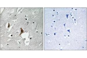 Immunohistochemistry analysis of paraffin-embedded human brain, using NMDAR2B (Phospho-Tyr1336) Antibody.