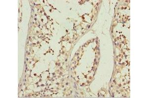 Immunohistochemistry of paraffin-embedded human testis tissue using ABIN7144897 at dilution of 1:100 (ABCB8 Antikörper  (AA 486-735))